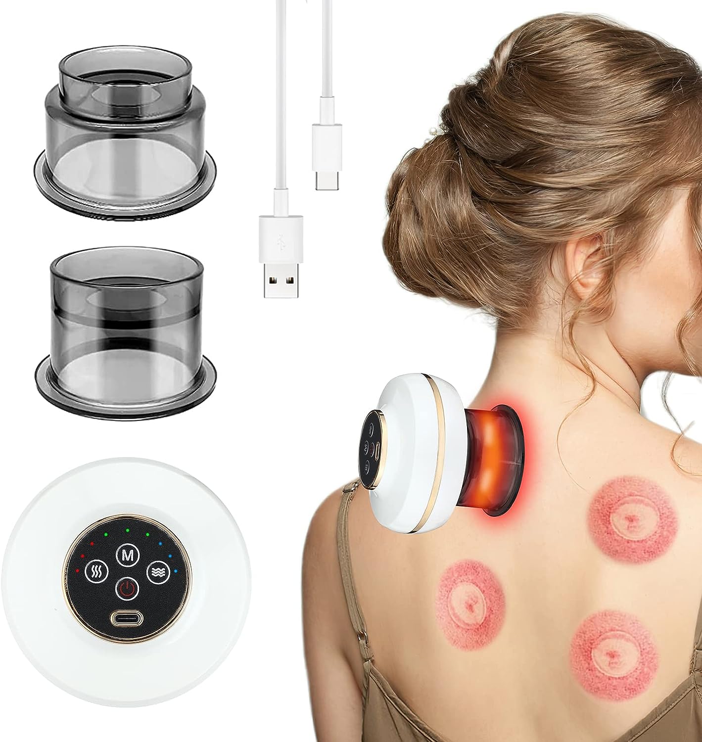 vacuum cupping